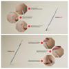Suvorna Ador Skin Care Pimple Blemish Remover & Comedone Extractor With Needle Point Lancet 1112 view 3