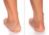 Cracked Heel Rough Spot Cream view 2