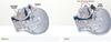 Pure Quiet Z's Sleep Stop Snoring Tongue Stabilizing Device view 3