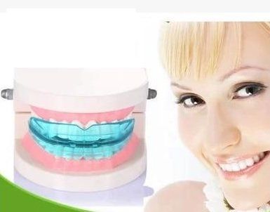 NavaFresh Basics Dental Oral Orthodontic Appliance Trainer Braces tooth Correction Buck Teeth Retainer Keep Uou Beautiful High Quality corrector