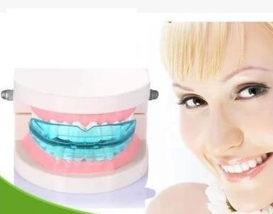NavaFresh Basics Dental Oral Orthodontic Appliance Trainer Braces tooth Correction Buck Teeth Retainer Keep Uou Beautiful High Quality corrector