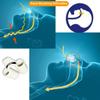 SNOREBEN Patented 2 Pcs Anti Snoring Device Unisex Sleep Stop Snoring Nose Vents, Snore Solutions Device Snore Stopper Sleep Aid, Anti Snoring Nose Clip, Snoring Stopper for Men & Women | Pack of 2 view 3
