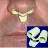 SNOREBEN Patented 2 Pcs Anti Snoring Device Unisex Sleep Stop Snoring Nose Vents, Snore Solutions Device Snore Stopper Sleep Aid, Anti Snoring Nose Clip, Snoring Stopper for Men & Women | Pack of 2 view 4
