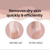 TRITON Professional Stainless Steel Lazer Foot Scraper,Filer for Hard n Dead Skin Callus Removal, Pedicure Foot Scrubber, Men n Women view 3