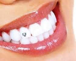 ADDLER TOOTH JEWELLERY SET OF 5 AESTHETIC LASTS LONG (CLEAR CRYSTALS) DENTAL