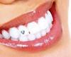 ADDLER TOOTH JEWELLERY SET OF 5 AESTHETIC LASTS LONG (CLEAR CRYSTALS) DENTAL view 1