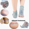 Kavid 1pair Silicone Gel Moisture Cracked Heel Sock Sock Heel Protection Sleeve Foot Care Tools Pedicure Heel Cushion Ankle Socks view 3