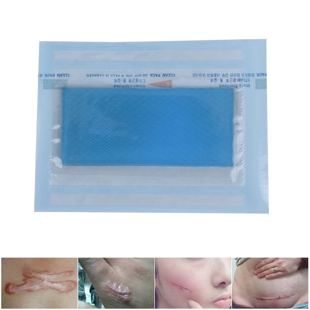 3nh Silicone Gel Sheet Wound Marks Scar Away Patch 3.5 * 7cm Removal Cesarean Section Hypertrophic Keloid Skin Scars Therapy Treatment