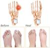 Anugrah Silicone Gel Half Toe Sleeve Anti-Skid Forefoot Soft Pads for Pain Relief heel front socks silicone Heel Protector view 3