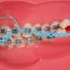 Colourful Dental Orthodontic Elastic Rubber Band Power Chain for Braces Short Long Continuous Sizes Orthodontic Treatment 1 pc (Long, Peacock blue) view 2