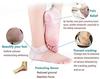 Shulabh Creative Silicone Gel Heel Pad Socks for Heel Swelling Pain Relief Ankle Support Cushion for unisex for Men and Women (Beige, Free Size) - 1 Pair (Biege) view 4
