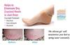 AFIYA Anti Crack Silicon Gel Heel And Foot Protector Moisturizing Socks for Foot Care Pain Relief for Men And Women 1 pair view 4