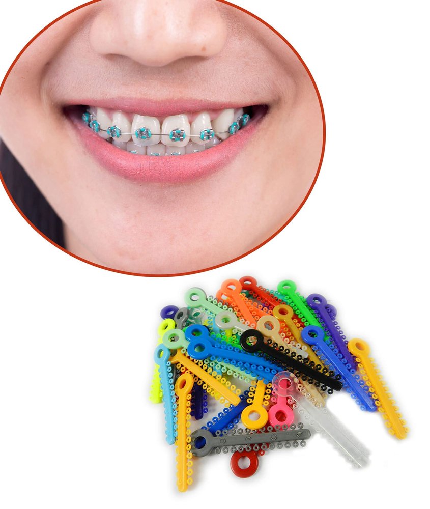 Dental Orthodontics Ligature Ties Light Force (Latex Free) / Ligature Ties For Braces 1008/pk in Multi Colours (Assorted)