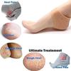 AFIYA Silicone Gel Heel Pad Skin Socks For Pain Relief Pain Protector Moisturizing Breathable Anti Crack Socks- 1 Pair view 3