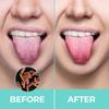 NCO Tongue Cleaner, Medical Grade Stainless Steel,Stainless Steel Tongue Cleaner for Both Adult and Kids, Professional Eliminate Bad Breath, Help Your Oral Hygiene: 3 Pcs Set view 2