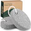2PCS Natural Pumice Stone for Feet - Asqraqo Lava Pedicure Tools Hard Skin Callus Remover for Feet and Hands - Natural Foot File Exfoliation to Remove Dead Skin, and Callusess view 1
