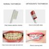 Boxed Portable Orthodontic Care Kit Orthodontic Toothbrush Kit for Braces for Orthodontic Patient Travel Oral Care Kit Dental Travel Kit Interdental Brush Dental Wax Dental Floss (8 Pcs/Pack)-Red view 4
