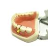 Angzhili Dental Interproximal Plastic Wedge(40 Pcs/Box) (Green) view 3