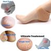 2V BROTHERS silicon anti crack heel pain relief moisturizing socks for Men and Women view 2