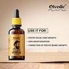 Olvedic Beard and Hair Growth Oil -30 ml for faster growth and thicker look | Natural Actives Only | No Harmful Chemicals | Best Oil for Patchy and Uneven Beard view 2