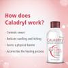 Caladryl Skin Allergy Expert Lotion for relief from skin rashes, sunburn, prickly heat, insect bites (65 ml) view 4