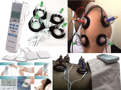 ACP Acupressure Electric Tens with cupping Tens Machine | Vacuum Cupping Set for Health Care | Cupping Kit for Pain Relief