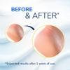 Dr. Scholl's Cracked Heel Repair Balm 2.5oz, with 25% Urea for Dry Cracked Feet, Heals and Moisturizes for Healthy Feet view 3
