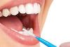 NMD Dental Intradental Brush view 1
