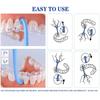 Dentosmile Aligner Remover Tool/Invisible Removable Braces, Invisible Aligner Remover-Aligner Remover-Fixer (Sparkling Blue) (1) view 4