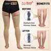 AccuSure Varicose Vein Stockings (Anatomical Shape,Easy to use, Non Slippagen, Durable)-Thigh Length for Varicose Veins Can Be Used By Men & Women (L) view 3