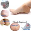 Afflatus Silicone Gel Heel Pad Socks for Pain Relief, Anti Crack Silicon Gel Heel And Foot Protector Moisturizing Socks for Foot Care for Men and Women (Beige, Free Size) - 1 Pair view 2