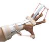 SALO Orthotics Dynamic Hand Splint for Right Hand - Thumb & Finger Extension Support for Carpal Tunnel, Radial Nerve Palsy, Stroke Recovery  (Size-Large, Right Hand) view 3