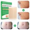 Professional Silicone Scar Sheets Removal, Treatment Stretch Mark Surgery Injury Burns Acne Keloid C-Section, And More Scar Patches, Old & New Scars, Reusable Scar Patches, 3"1.6"x4 (60 Day Supply) view 2