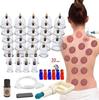 Mify Biomagnetic Chinese Vacuum Cupping Therapy Set 32 Cup Massager view 2