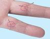 Acupro Health Care System Acupuncture Sujok Needle (Size 0.18 x 7mm) Hand Acupuncture - Pack of 500 view 4