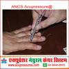 ANCS Sujok Acupressure Needle Inserter with Sujok Needle (Total Set of 50 Needles) view 4