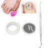 Ingrown Toenail Corrector, Wearable Convenient Paronychia Treatment Tool for Foot Care for Keeping Healthy view 4