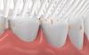 DC DECORIO- A UNIQUE PRODUCT RANGE Dc Decorio Tooth Brush Head 360 Degree Cleansing U Shaped Toothbrush For Kids Baby (Rainbow-Pink), Manual, Pack of 1 view 2