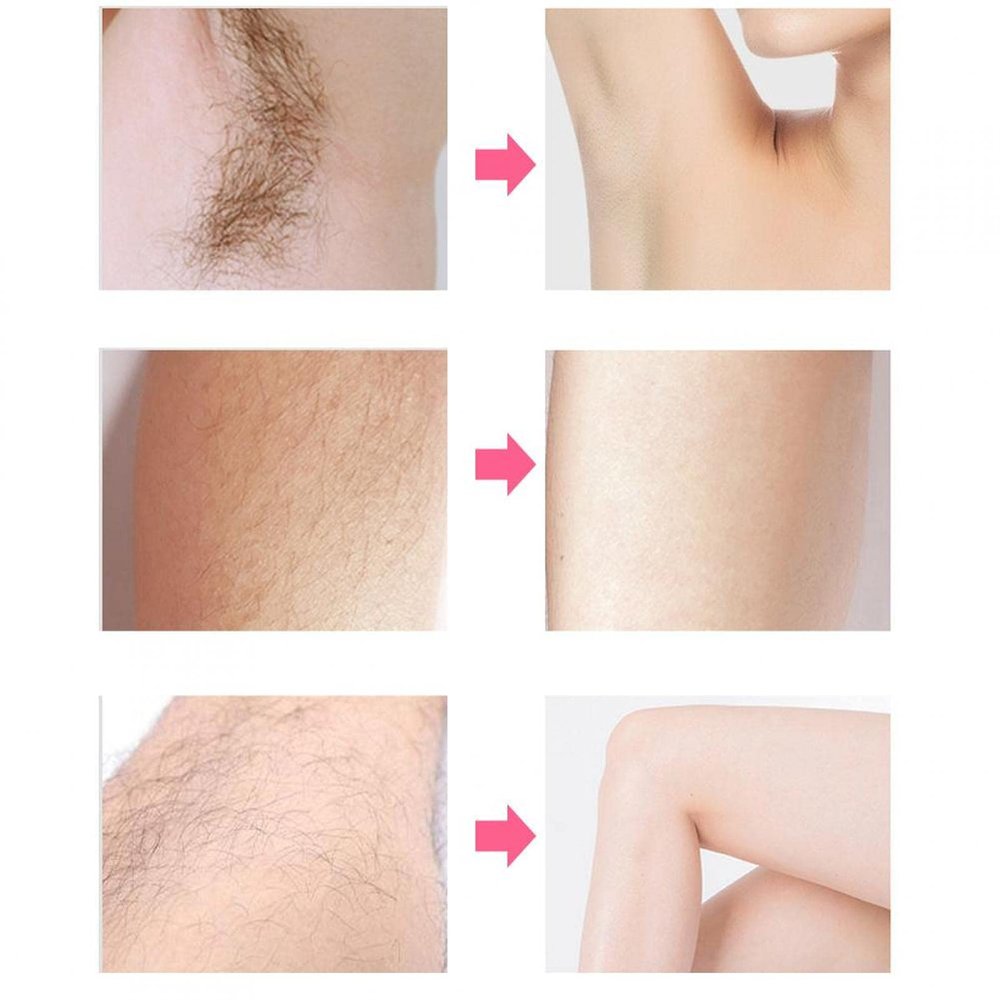 Eyebrow Trimmer, USB Electric Facial Hair Remover, Remover for Woman Shaving Hair Removal Eyebrow Trimming