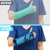 6 Pack Arm Cast Cover Elastic Cast Sleeve Arm Decorative Cast Cover Removable Washable Arm Cast Protector view 3