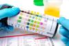 Urisign Glucose, Bilirubin, Ketone, SG, Blood, PH, Protein, Urobilinogen, Nitrite and Leukocytes, Urine Test Strips 10 Parameter 50 Strips view 4