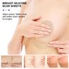 Silicone Scar Sheets, Silicone Scar Sheets for Breast 8 Pack, Breast Reduction After Surgery for Scars, Scar Removal Sheets, 4 Areola Soft Strips & 4 Anchor Sheets view 2
