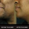 TEACURRY Facial Hair Tea (2 Month Pack | 60 Pyramid Tea Bags) - Helps with Facial Hair Removal and Unwanted Hair Removal view 3