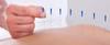 4beauty Therapy Dry Needles Physiotherapy Acupuncture Combo Pack Of 2 (Size 0.25x13, 0.25x25) Each Box 100 Needles view 2