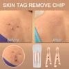 12 Pieces Skin Tag Removal Clips Small Clip for Getting Skin Tag Wart Tag Out Metal Skin Tag r Wart Extractor view 2