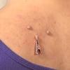 12 Pieces Skin Tag Removal Clips Small Clip for Getting Skin Tag Wart Tag Out Metal Skin Tag r Wart Extractor view 3