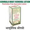 Massa Mukti Lotion, For Permanent Remove Of Wart Painless Solution And Save Time & Money, 25 Ml. Bottel Pack,Qty.-Pack Of 1 view 3