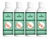 Oilanic After Waxing Lotion for Men and Women (Pack of 4, Each 100 ml)|Soothing and Nourishing Skin Care for Smooth and Soft Feel Helps Reduce Dryness Hydrates and Refreshes Non Greasy Formula| view 1