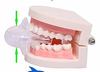 Frackson Tongue Anti Snoring Device Medical Silicone Anti Snore Device Apnea Aid Snore Stopper Tongue Retainer Anti Snoring Mouthpiece view 3