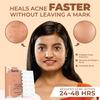 Sanfe Skin Care Combo - Promise Face Acne Patch (36 Count) & Hair Removal Gel (100ml) | Pimple Healing with Hydrocolloid | Natural Extracts of Aloe Vera & Coconut | Complete Beauty Care view 3